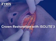 Watch Video: Zyris - Crown Restoration with ISOLITE<sup>®</sup> 3