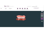 Kulzer Partners with DENTCA for Digital Denture Workflow