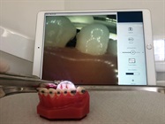 New Dental Product: SMARTmirror Camera Equipped Dental Mirror from SMARTmirror