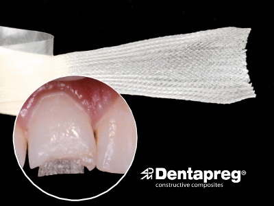 Save teeth! Save time!