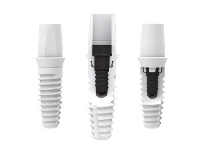 Finally a Ceramic Implant that offers restorative options and reliability