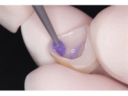 New Dental Product: KATANA Intraoral and Restoration Cleaner from Kuraray Noritake