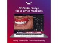 Enhanced Dental Product: SmileFy Smile Design Software
