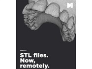 Smart STL Now Available From DentalMonitoring
