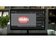 Align Technology Introduces New SmartForce Feature to Minimize Attachments