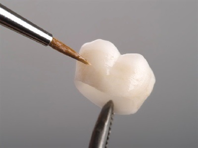 Dental Ceramic Systems