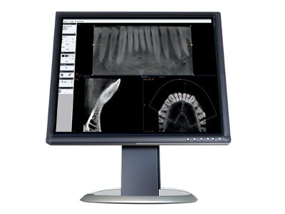 Oral Surgery Imaging Software