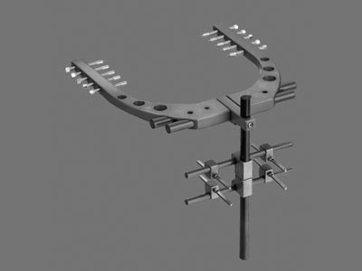External Distraction Osteogenesis Products