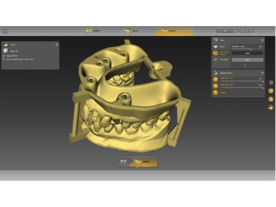inLab CAD SW 18 from Dentsply Sirona CAD/CAM | Dentalcompare: Top ...