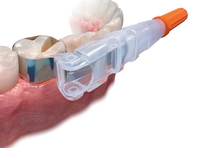 Omni-Matrix Disposable Retainer And Matrix