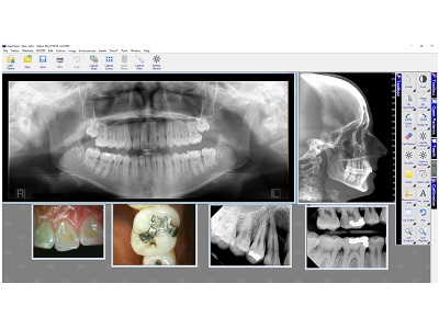 Dental Image Management Software | Dentalcompare.com